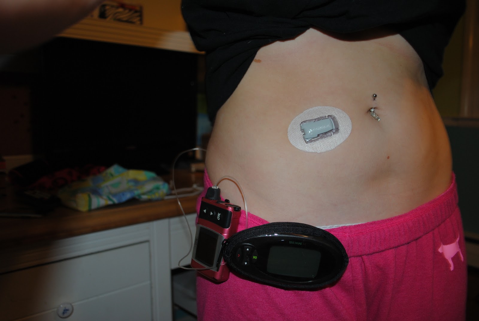 Dexcom 7