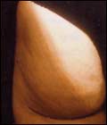 [cellulitepost1.jpg]