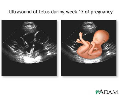 3d ultrasound 20 weeks pregnant. Getting Pregnant Pregnancy