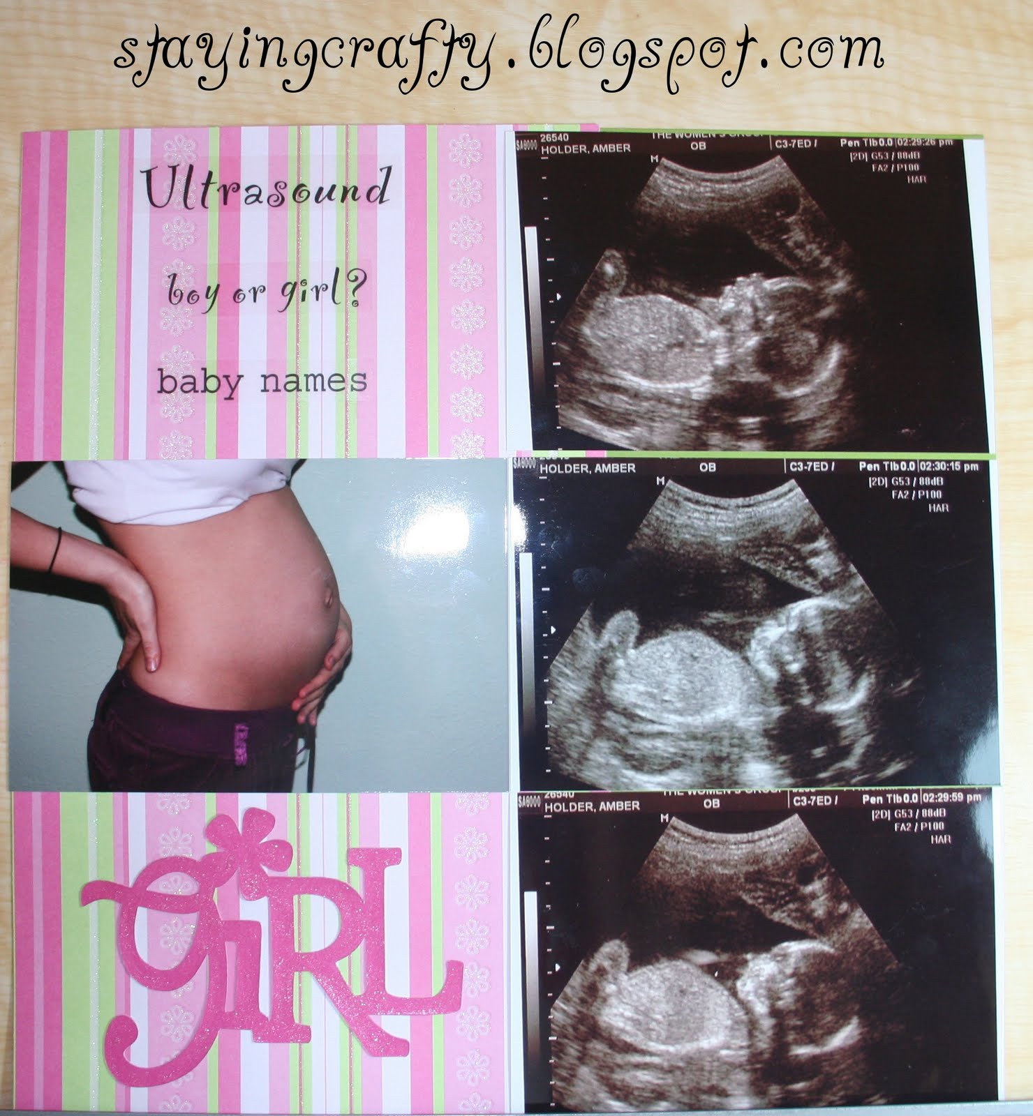 Cute Ways to Use Ultrasound Pictures - Peppy Prints
