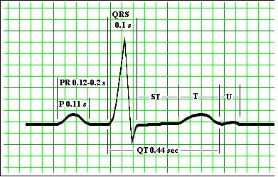 ekg ecg basic wave interval measurements waves heart reading qt cardiac qrs parts rate electrocardiogram nursing normal boxes waveform madsci