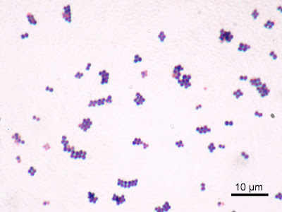 staphylococcus aureus bronchitis