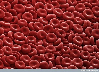 Enlarged Blood Cells