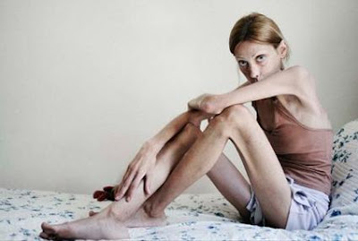 modelos con anorexia isabelle caro modelos con anorexia isabelle caro