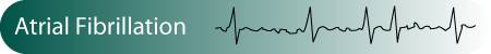[AtrialFib.png]