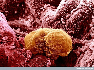15 imágenes microscópicas del cuerpo humano. 15.+Colored+image+of+a+6+day+old+human+embryo