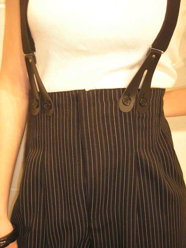 Everything About Braces Placement of Brace Buttons