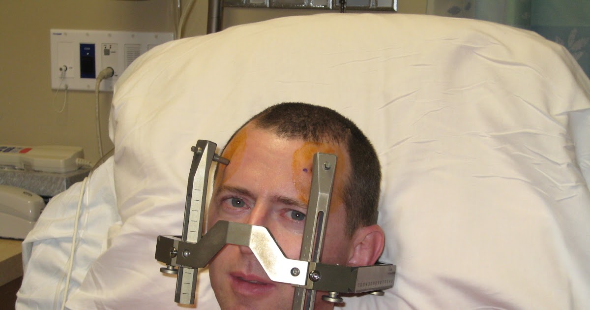 Jeff's Daily Update Under the Gamma knife