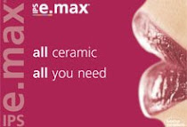 E-max ceramic crown