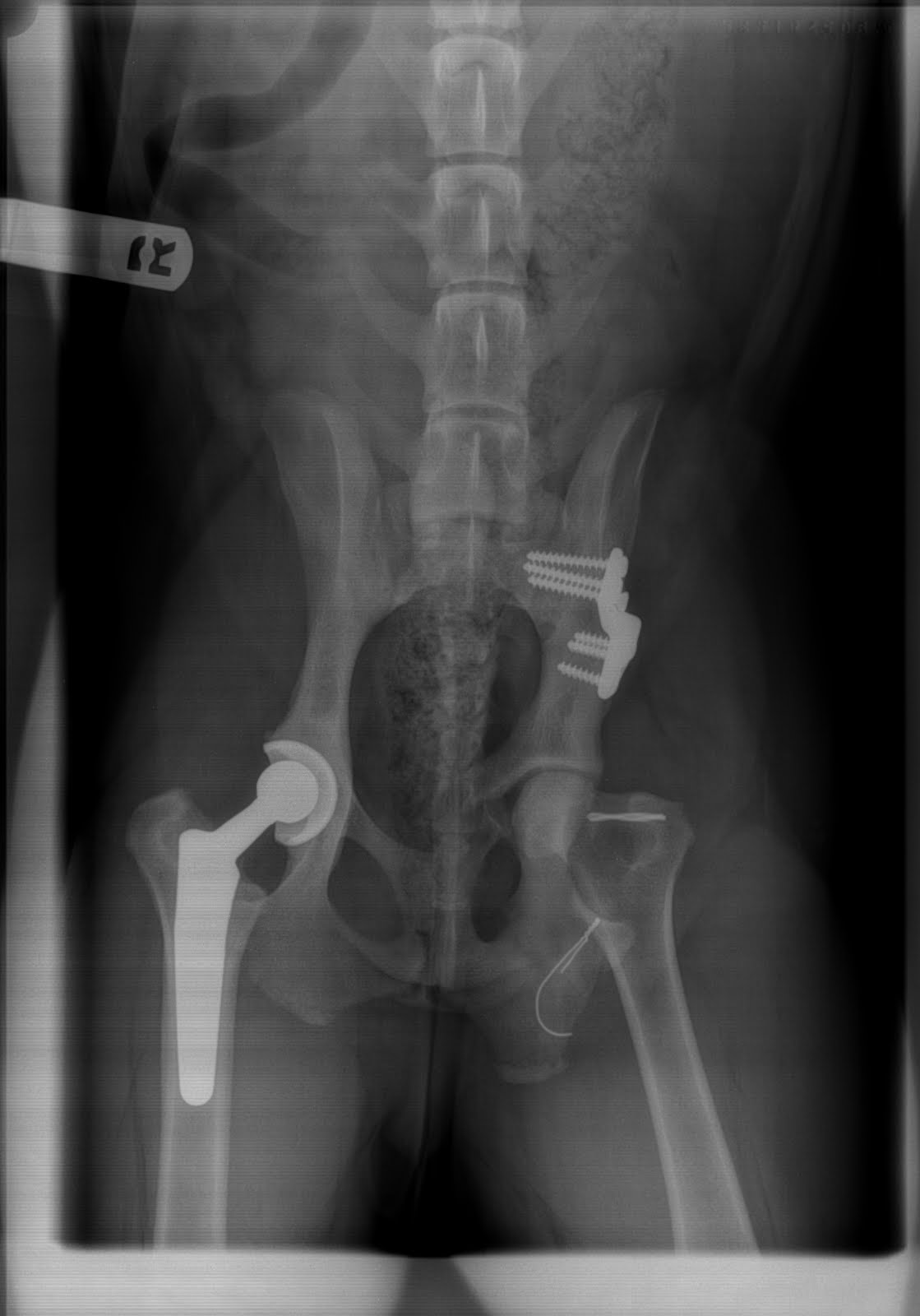 Lower back pain and pain in my right leg golf, why does sitting cause