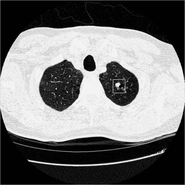 Lung+ct+scan+images