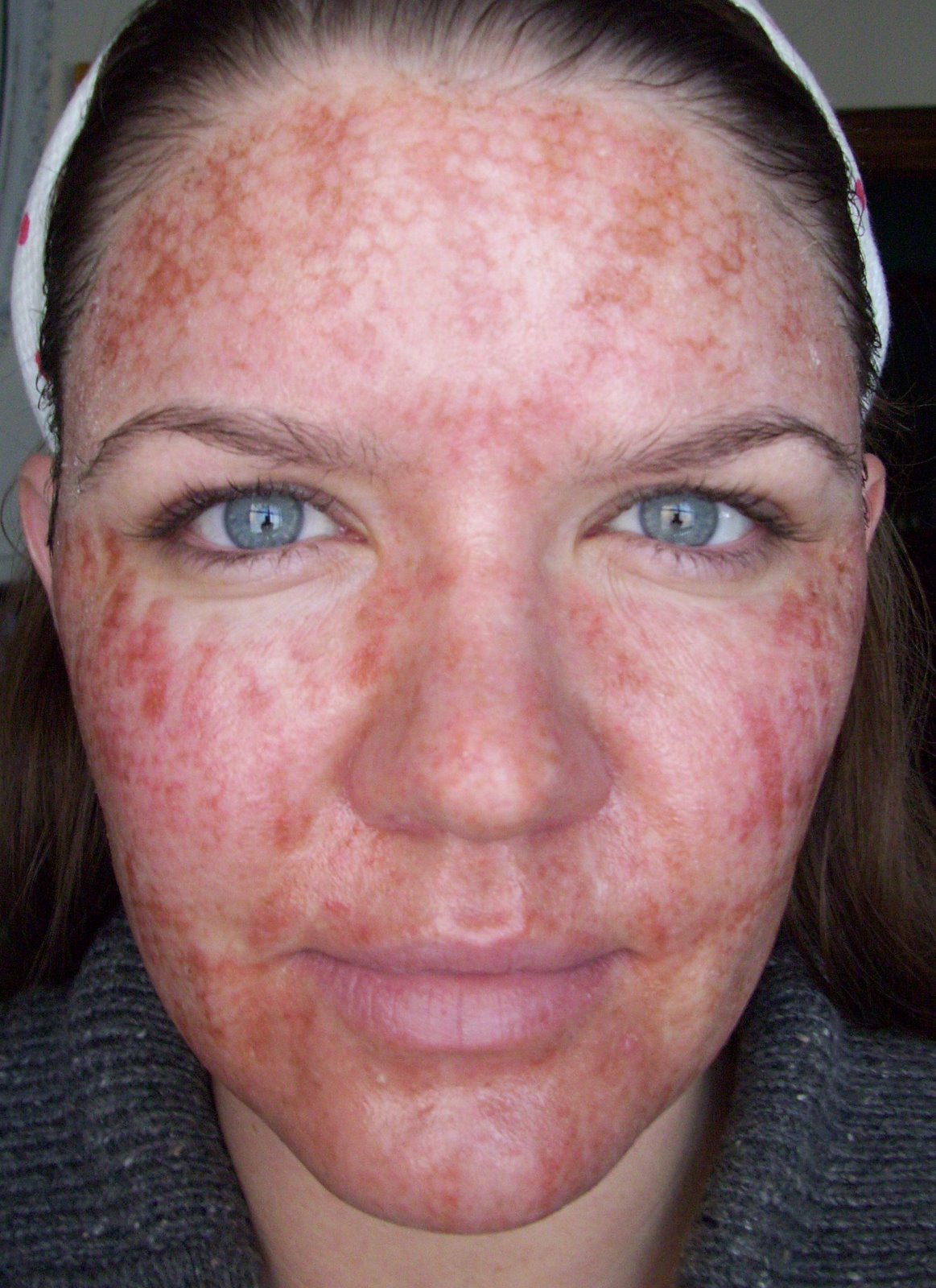 [Post+Pearl+Day+1+Striping+Full+Face.JPG]