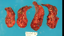 my old lungs (transverse cuts)