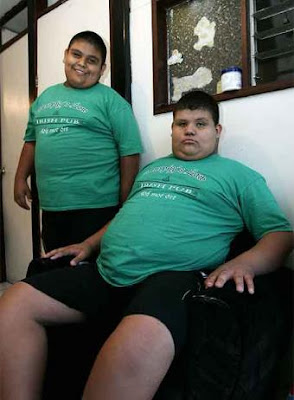 gemelos obesos