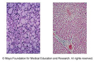 liver slide