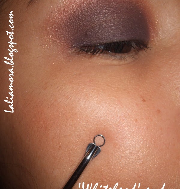 Def Share2 Avon Blackhead And Whitehead Remover Directions On How To Use Blackhead Removal Tools