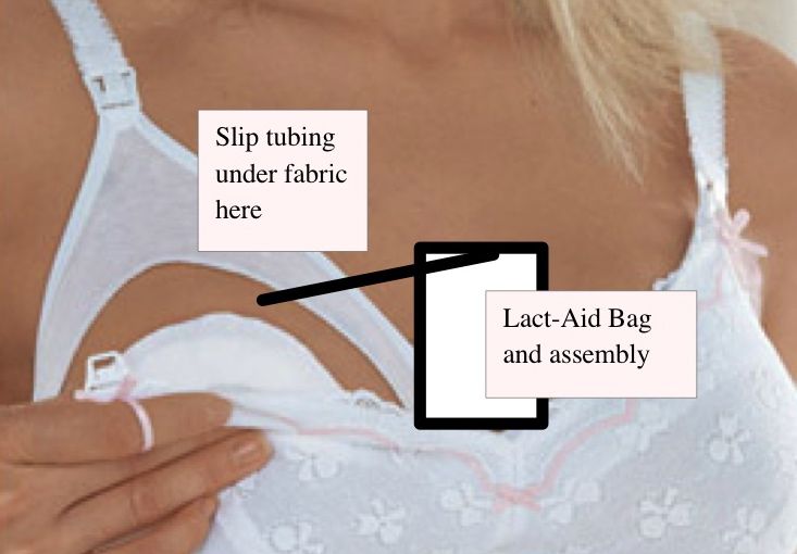 Breastfeeding Supplementer