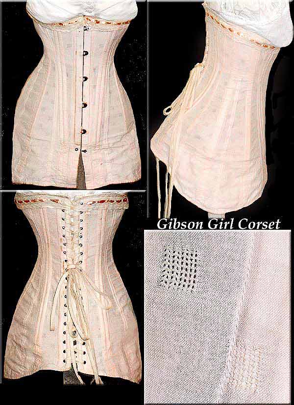 corset deformities