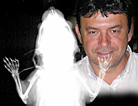 Montagem: o vereador e uma radiografia de ratinho