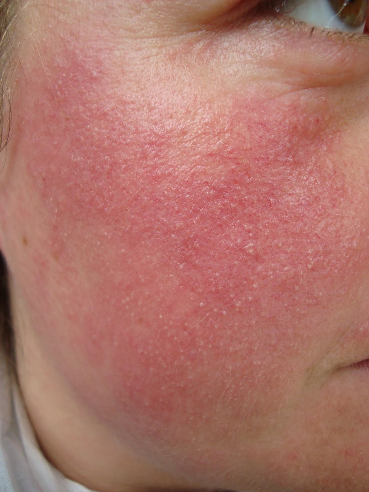 La que sigue aquí octubre 2010