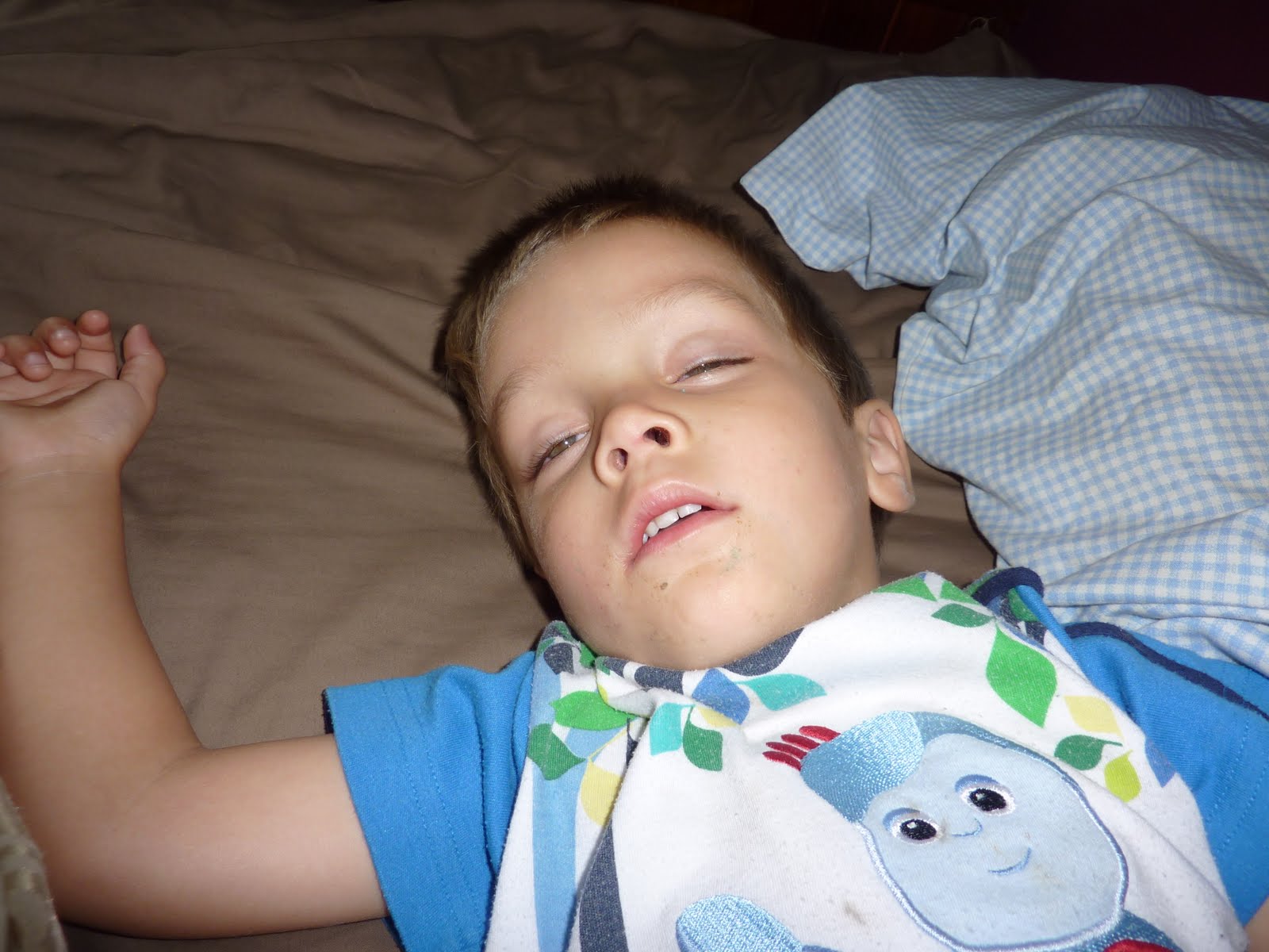 Sleep apnea therapies, why do i sleep talk with my eyes open