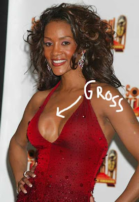 Vivica Fox Breast Implants