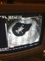 8 Week Ultrasound