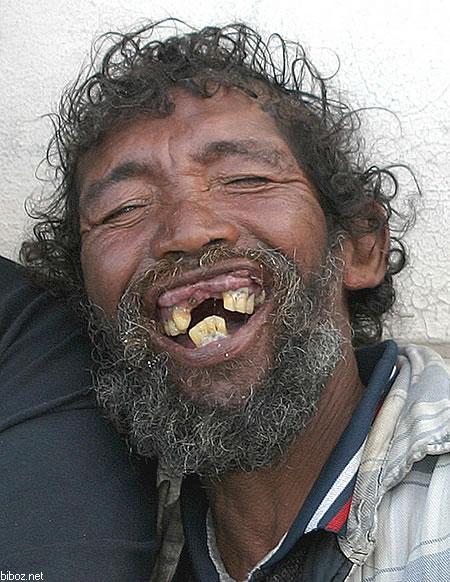 Pelo Feo