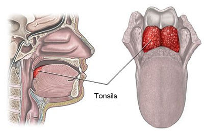 ubat tonsil