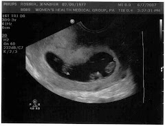 First Sonogram 6/7/2007 9weeks