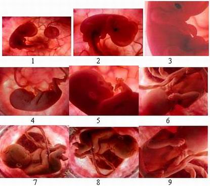 Pertumbuhan & Perkembangan: Pertumbuhan dan Perkembangan ...