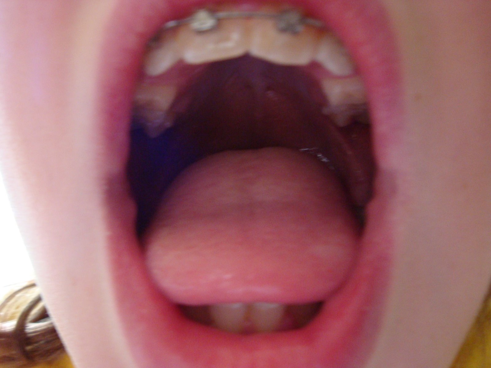 [DSC00475.JPG]