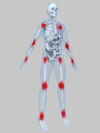 [dolor+de+las+articulaciones.jpg]