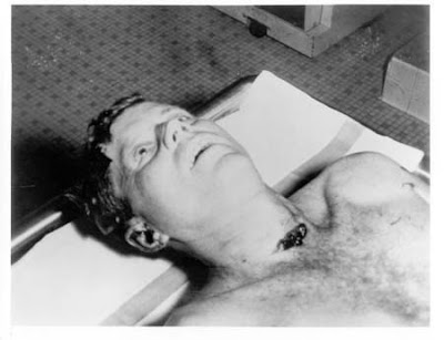 The JFK Assassination in two kennedy assassination autopsy pictures. The JFK Assassination in two