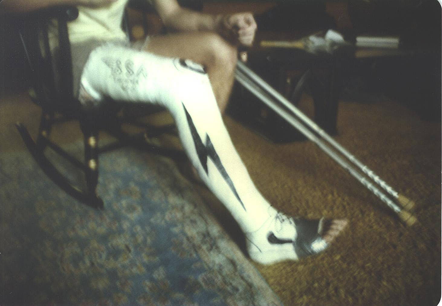 [leg_in_cast_1978.jpg]