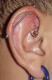 How To Treat Ears Pierced Infection