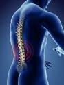 back pain relief spray