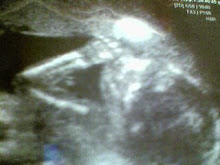 Baby Ross, 5 months in the womb