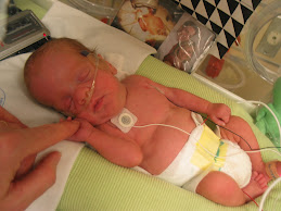 Braden
