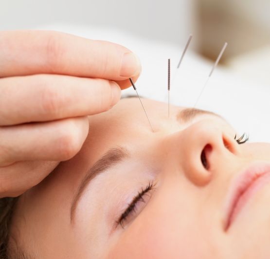 Healthy Life Can acupuncture help my health problem?