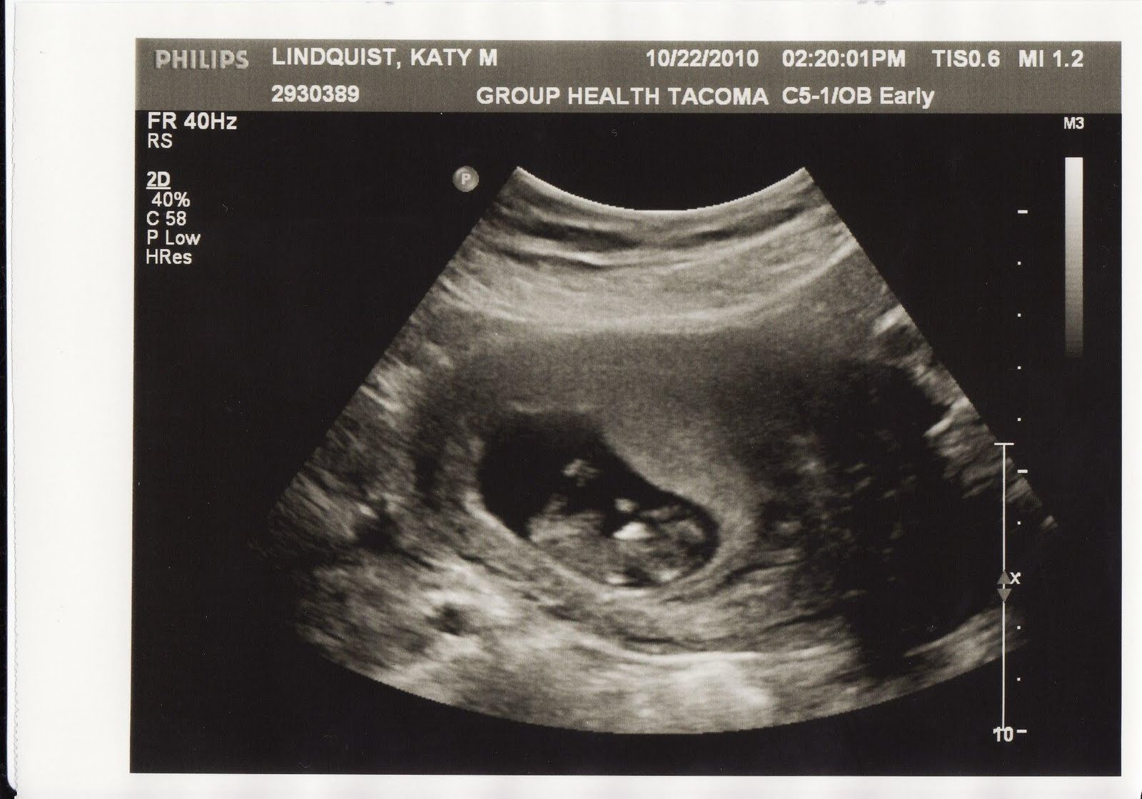 the lindquist four October 2010