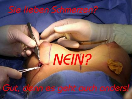 Die Preise der Kodierung vom Alkoholismus kemerowo
