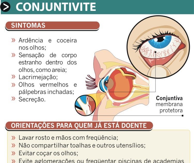 Eder Souza Designer Infográfico Conjuntivite