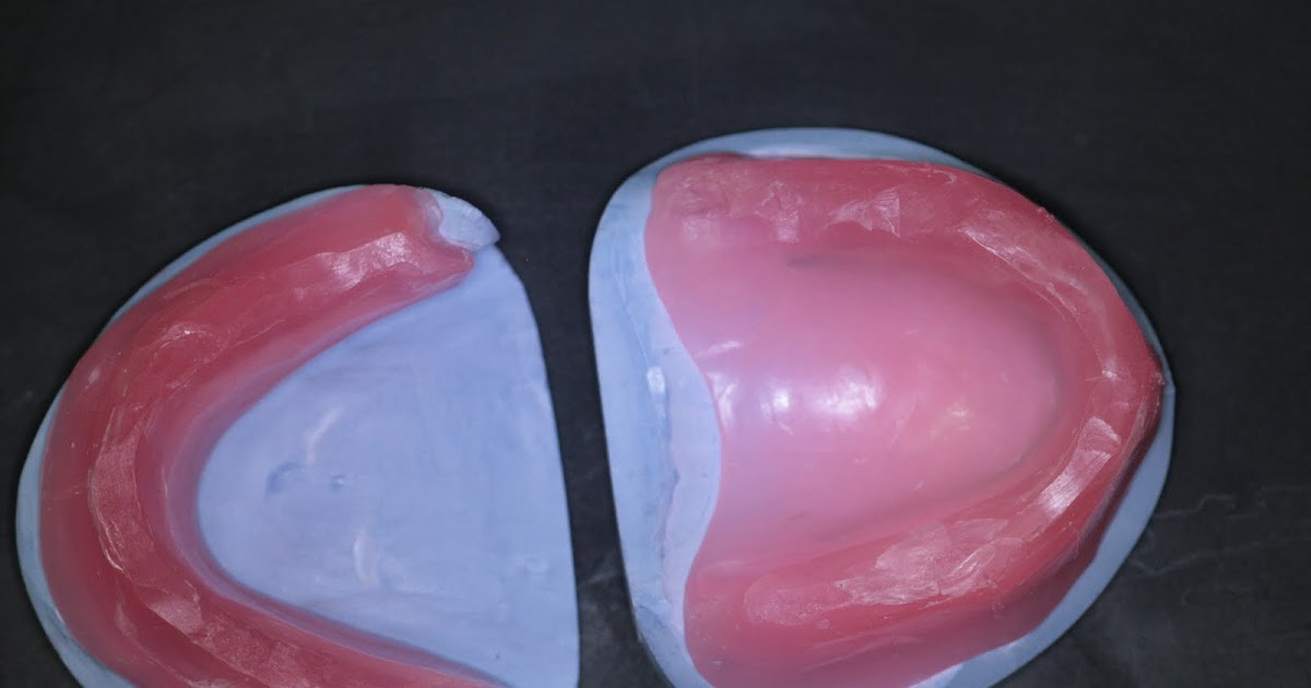 SBO Dental Laboratory Get your Bite Blocks functional