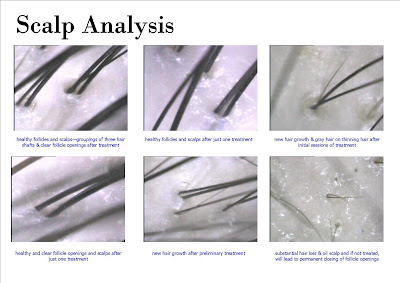 Scalp Analysis