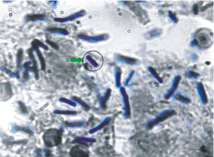 [bacterias.jpg]