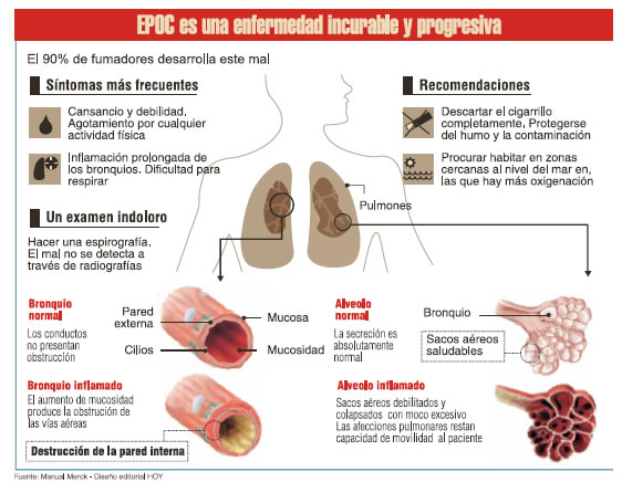 El preparado de la dependencia alcohólica lidevin