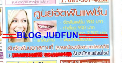 http://4.bp.blogspot.com/_wA7ABeWvA5o/SrWD3V57Z_I/AAAAAAAABJc/AdiPPuQ-cbE/s400/addydente-1228121355-117-47-156-137.jpg