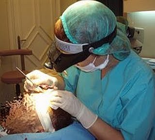 Haartransplantation | Türkei | Istanbul