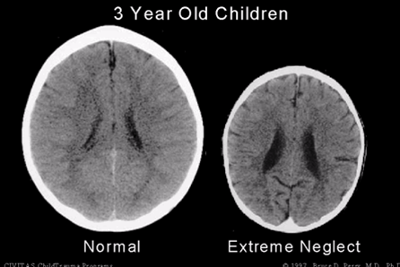 research paper on child abuse and neglect research paper on child abuse and neglect